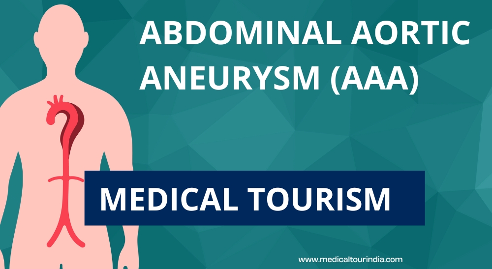 Abdominal Aortic Aneurysm AAA