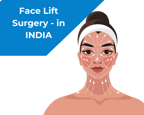face-lift-surgery.png